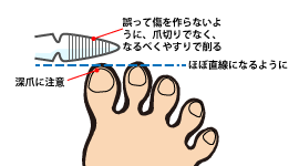 糖尿病のフットケア すこやか便り 金氏高麗人参株式会社